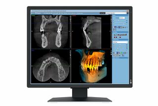 Eizo Radiforce Mx217-sb Écran Plat De Pc 53,3 Cm (21") 1200 X 1600 Pixels Uxga Lcd Noir
